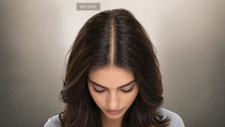 'BEFORE' shot of a woman looking down to show flaking and dullness along her dark brown parting